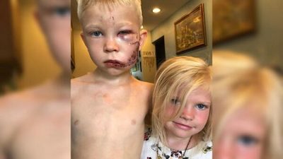 Niño salva a su hermana menor de ataque de perro