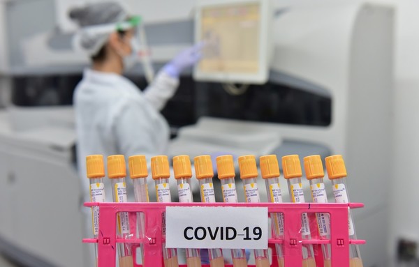 En la FRONTERA hay 3.319 casos de COVID19, cifra superior al que registra el Paraguay