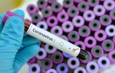 Confirman tres casos de Covid-19 en oficinas del Ministerio de Salud