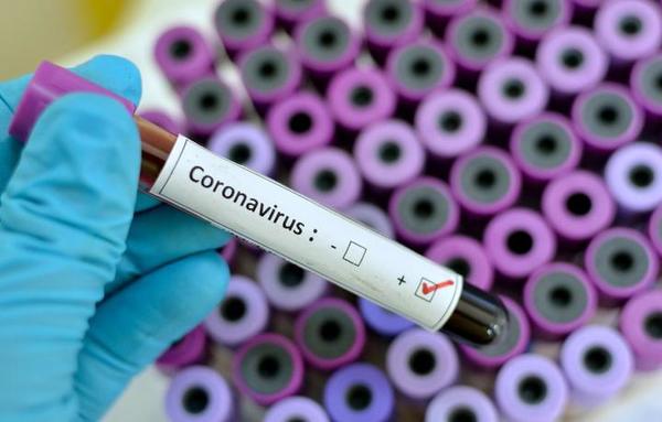 Confirman tres casos de Covid-19 en oficinas del Ministerio de Salud