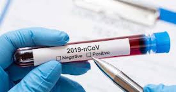 Salud informa 3 casos positivos de COVID-19 en sus oficinas del nivel central