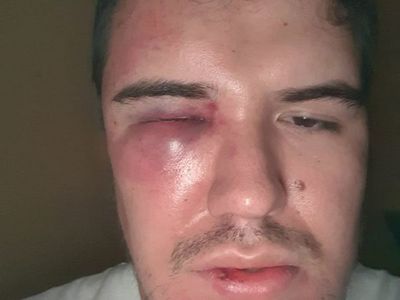 Miembro de comité de Ética de la APF reventó a golpes a su empleado