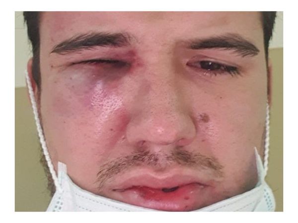 Jefe acusado de agredir a su empleado asegura que solo se defendió