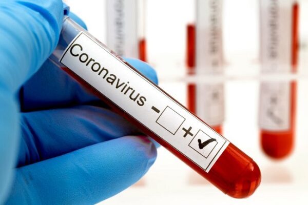 Uno de los fallecidos por Covid-19 era adicto a las drogas