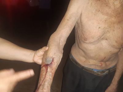 Anciano de 93 años fue golpeado por su propio yerno - Nacionales - ABC Color