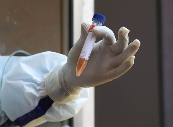 La vacuna china contra la COVID-19 llega a Brasil para ser testada - Mundo - ABC Color