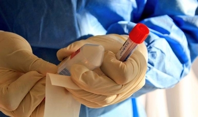 HOY / Tests de COVID-19 a futbolistas: “Probablemente haya habido una contaminación del material”