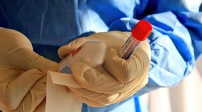 Tests de COVID-19 a futbolistas: “Probablemente haya habido una contaminación del material”