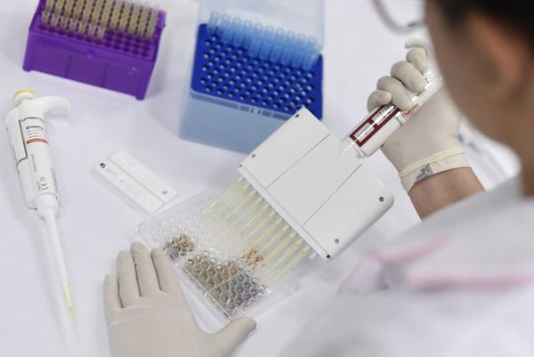 Test a futbolistas: para hematólogo, muestras estaban contaminadas - Nacionales - ABC Color