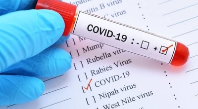 HOY / Confirman 69 casos de COVID-19, con 23 sin nexo, y suman dos nuevos fallecidos a la lista