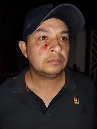 Intendente de Capitán Bado denuncia agresión por parte de concejal