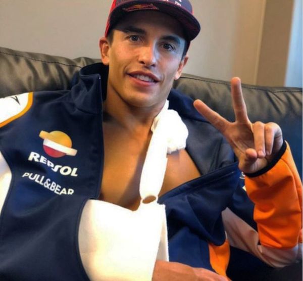 Marc Márquez fue operado “con éxito” - Automovilismo - ABC Color