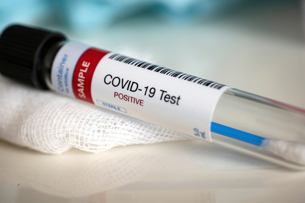 Se registran más de 2.600 casos en 224 brotes activos de coronavirus en España » Ñanduti