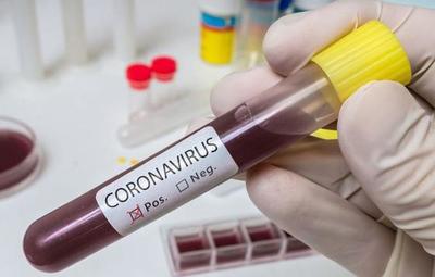 Inusual pedido en Sicilia: “Háganse el test, aunque sus esposas los echen de casa”