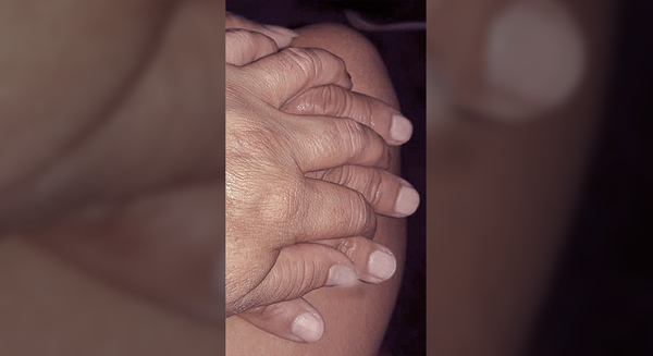 “CUANDO TE CURES DEL CORONAVIRUS TE VOY A ABRAZAR DE NUEVO MAMÁ»