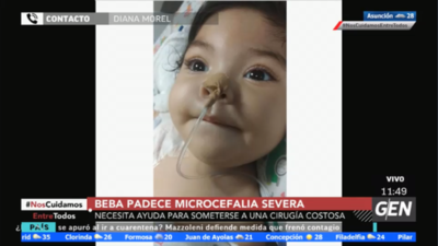 HOY / Diana Morel, madre de la pequeña Génesis que padece microcefalia severa y necesita someterse a una costosa cirugía