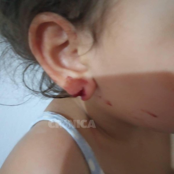 Por no tener Covid no le atendieron a su hija, ndaje | Crónica