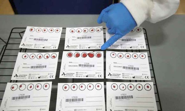 Dio positivo a virus vai ¡15 veces!, sin síntomas | Crónica