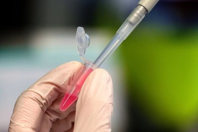 Científicos de Israel y EEUU creen que una droga para el colesterol podría convertir al COVID en un simple resfriado - ADN Paraguayo