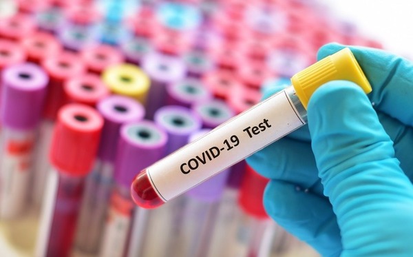 EEUU autorizó el primer test para detectar casos asintomáticos de Covid-19 - Megacadena — Últimas Noticias de Paraguay