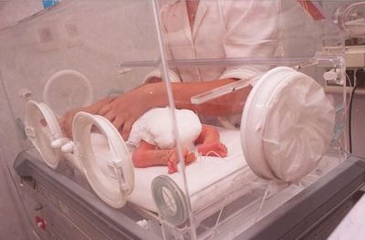 Bebé prematuro necesita de terapia intensiva - Nacionales - ABC Color