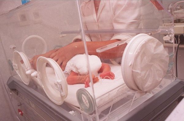 Bebé prematuro necesita de terapia intensiva - Nacionales - ABC Color