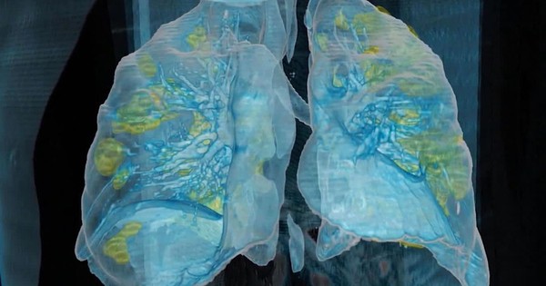 Las vacunas contra el covid-19 ya están en plena carrera en todo el mundo