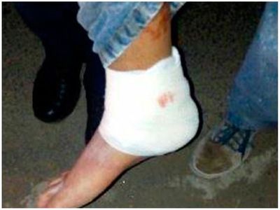 Le dispararon en el pie y cree que fue por una chica