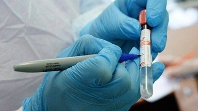 HOY / Resultados tardíos del test de COVID-19: experto afirma que "no vale la pena" esperar más de 3 días