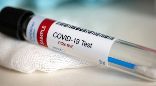 Confirman 104 casos de COVID-19, con 31 sin nexo, y suman dos nuevos fallecidos a la lista