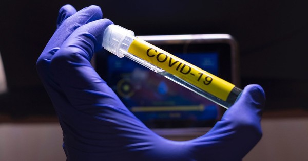 Itapúa registra 2 nuevos casos de COVID-19