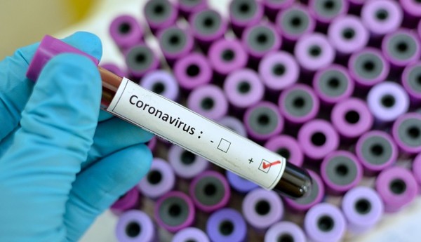 Salud evalúa cambio de estrategia ante circulación viral sostenida de Covid-19