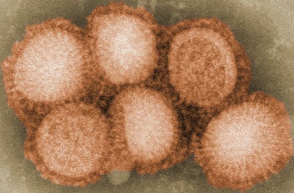 Nueva cepa de A H1N2 “con potencial pandémico”, advierten en Brasil