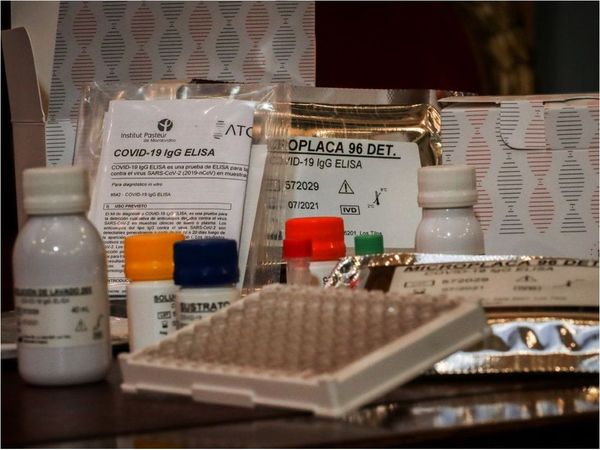 Uruguayos desarrollan test serológicos del Covid-19