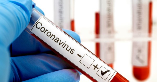Cordillera confirma 3 nuevos casos de coronavirus