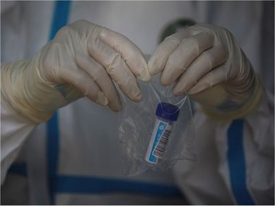 Anestesióloga pide a Salud sinceridad sobre cantidad de tests