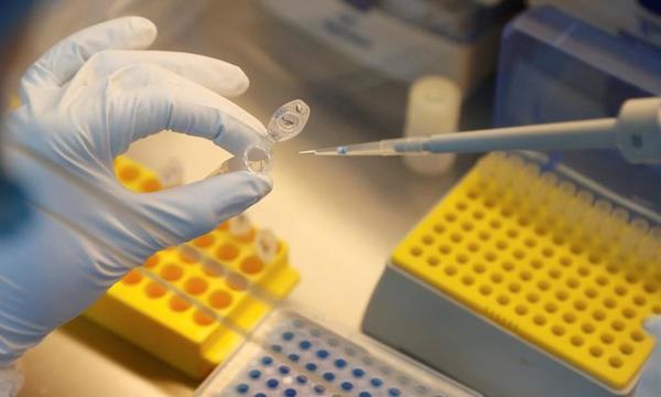 Rusia planea aprobar y comenzar a utilizar una vacuna contra el coronavirus en agosto y sin terminar las pruebas – Prensa 5