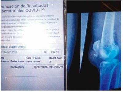 Operaciones, solo si tenés tu test de COVID