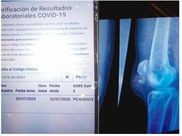 Operaciones, solo si tenés tu test de COVID