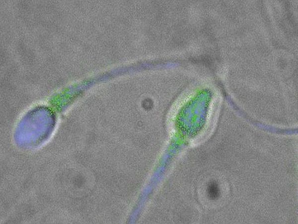 Los espermatozoides humanos no nadan de la forma que se creía hasta ahora