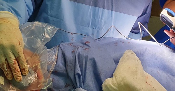 Por primera vez aplican bomba de baclofeno para lesiones medulares y cerebrales