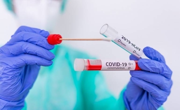 HOY / Confirman 159 nuevos casos de COVID-19, con casi 60 sin nexo: suman otros 180 recuperados