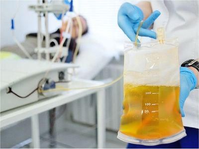 Covid-19: ¿Cómo es el tratamiento con plasma convaleciente?