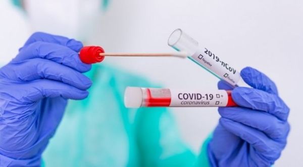 Por primera vez Paraguay confirma cuatro fallecidos por COVID-19 y 16 internados en terapia intensiva