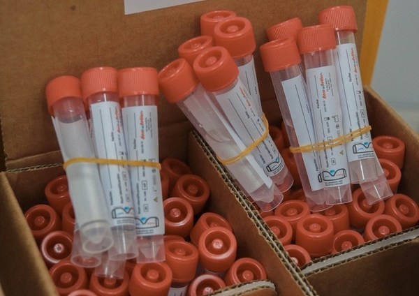 Laboratorio de Ciudad del Este procesará 400 muestras de Covid-19 por día, dice viceministro - ADN Paraguayo