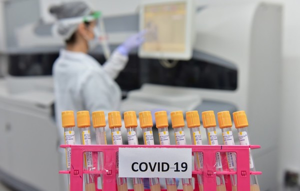 Rápida RECUPERACIÓN de enfermos de COVID19 en FOZ