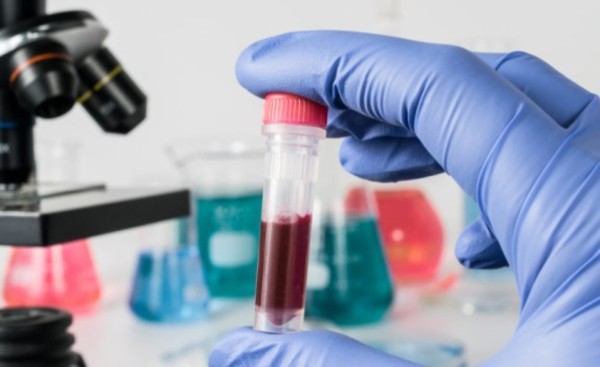 ¿Qué tan efectiva es la prueba de sangre para detectar el covid?
