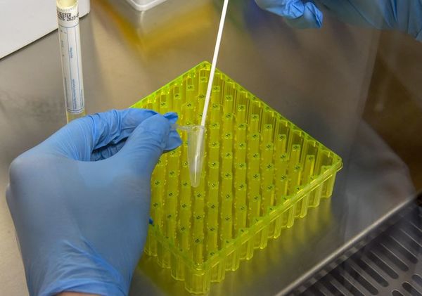Un nuevo sistema ayudará a detectar casos de covid-19 a través de la voz y la tos - Tecnología - ABC Color