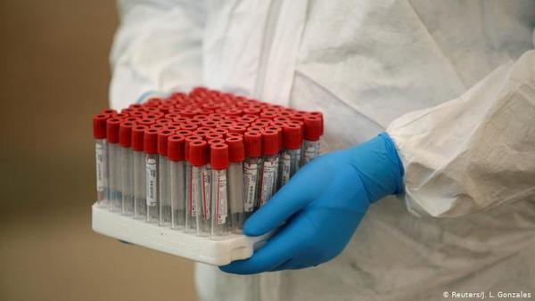 Laboratorios no realizaron pruebas nuevas de Covid para priorizar resultados de tomas anteriores - ADN Paraguayo