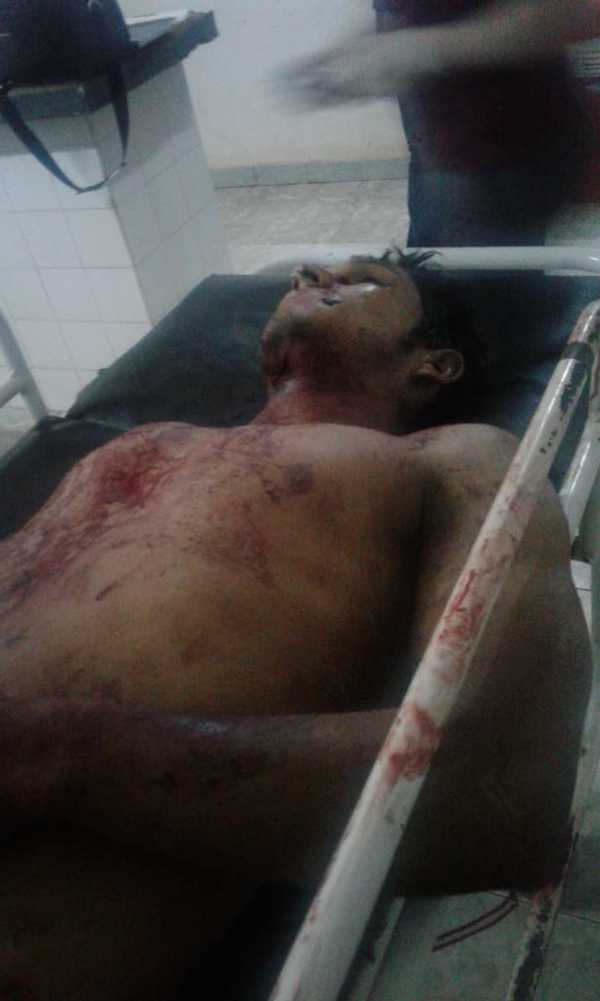INDIGENTE con orden de captura es ultimado de un balazo
